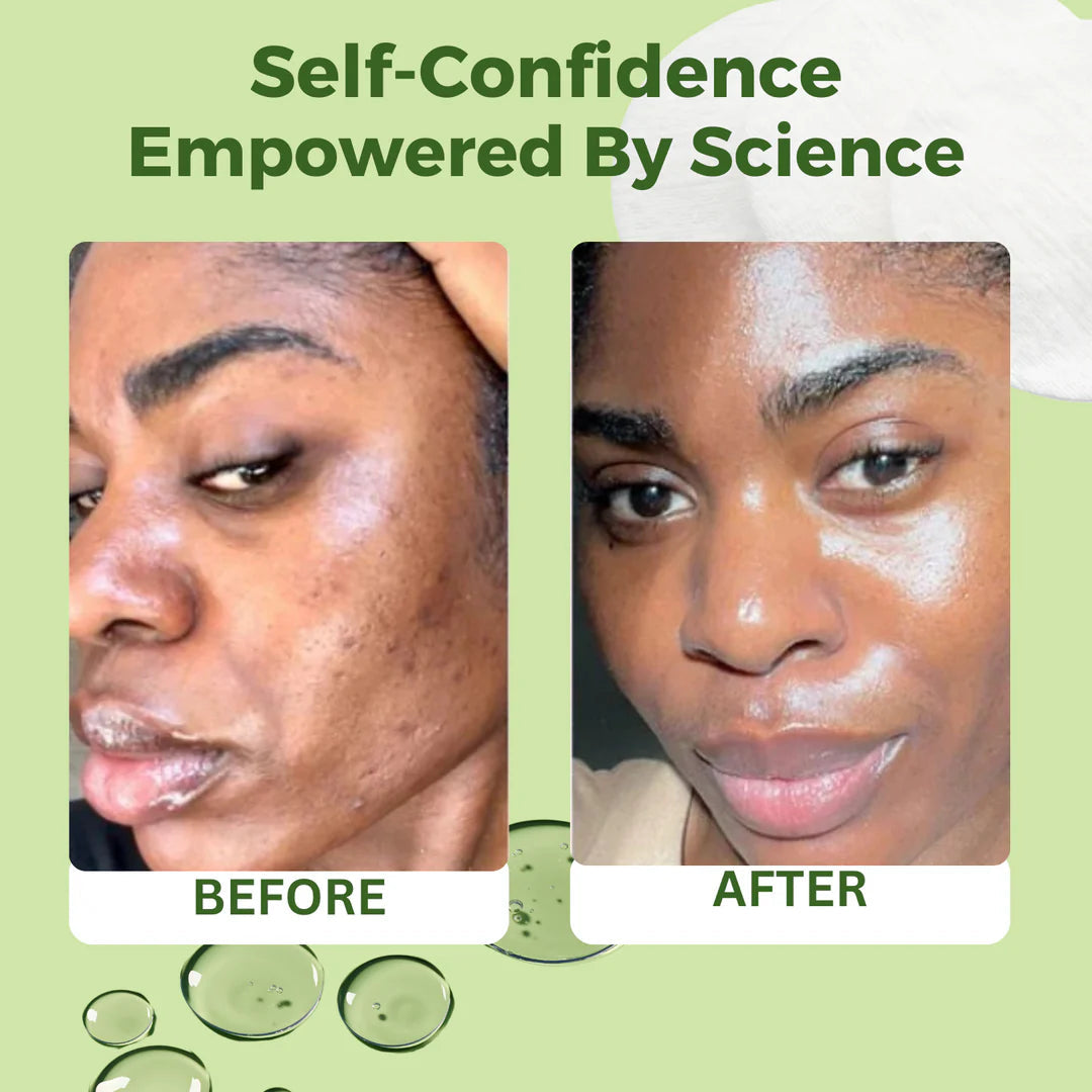 JiYu Toner Pads for Anti-aging – 100 ct