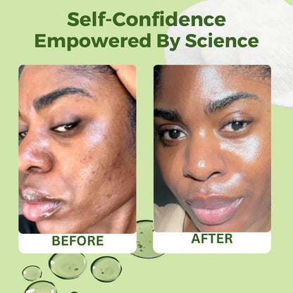 JiYu Toner Pads for Anti-aging – 100 ct